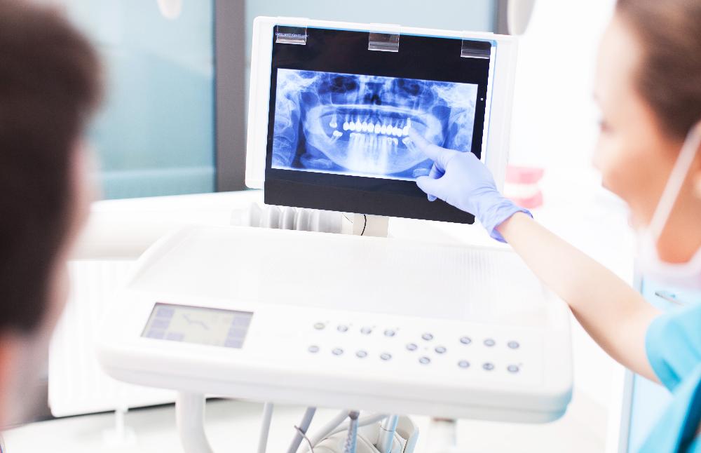 close up of x-ray | dentist apple valley mn