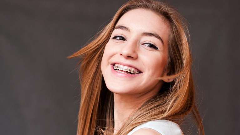 woman with braces smiling | orthodontics apple valley mn