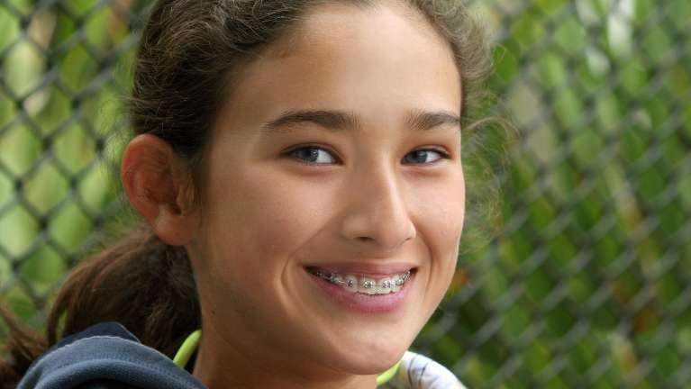 teenager with braces smiling | braces apple valley mn
