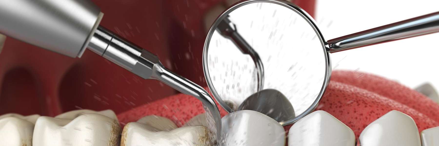 close up of dental exam tool | preventive dental care apple valley